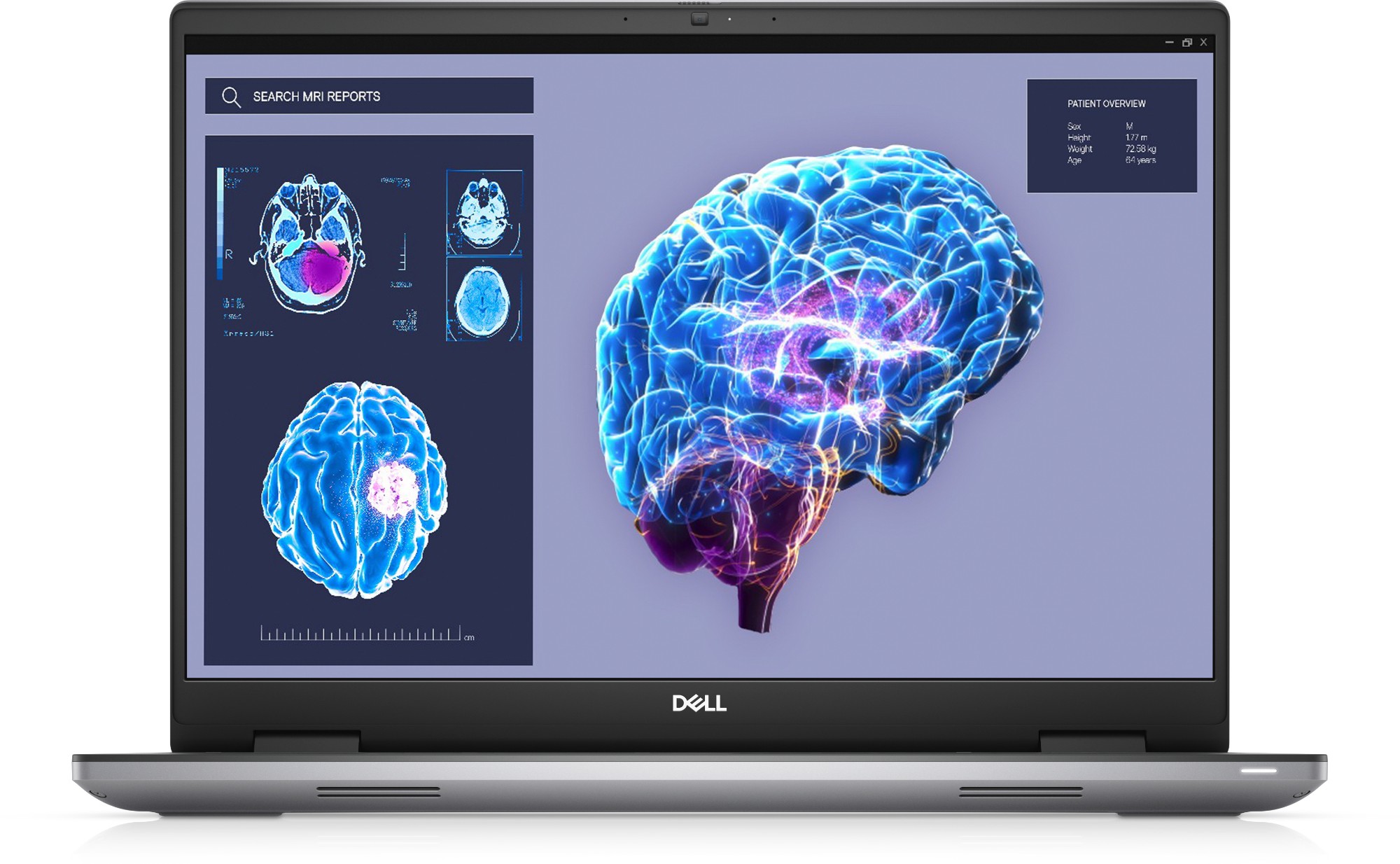 DELL Precision 7680 Intel® Core™ i7 i7-13850HX Mobile workstation 40.6 cm (16") Full HD+ 32 GB DDR5-SDRAM 1 TB SSD NVIDIA RTX 3500 Ada Wi-Fi 6E (802.11ax) Windows 11 Pro UK English Grey